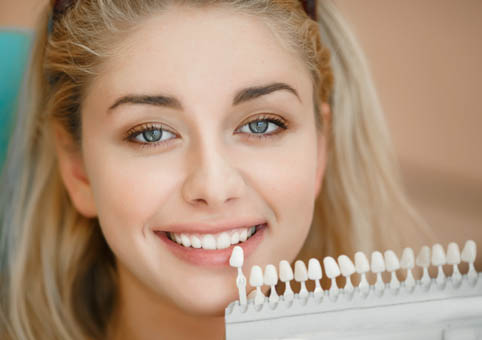 Bleaching | professionelle Zahnaufhellung Bleaching | professionelle Zahnaufhellung